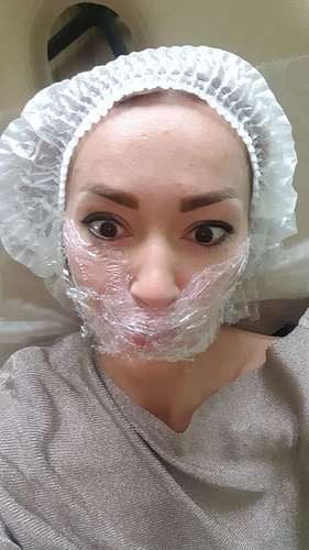 botox-tilburg-ervaring