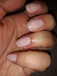 nagels