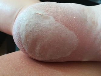 37